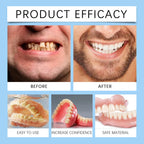 Temporary Silicone Snap-On Dentures for Instant Smile Whitening
