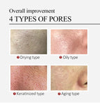 Salicylic Acid Pore Refining and Acne Repair Cream