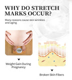 Mango Stretch Mark Cream and Repair Oil for Maternity Skin Care