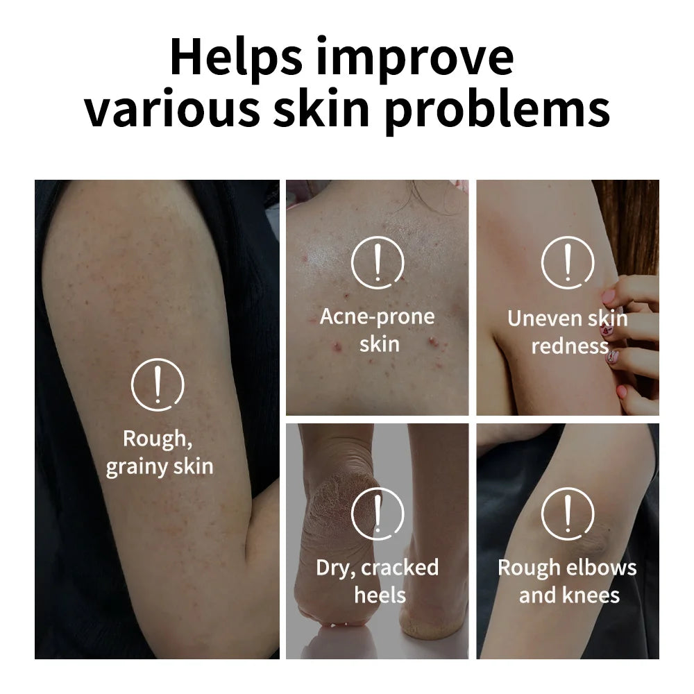 Glycolic Acid Exfoliating Body Stick for Smooth Skin