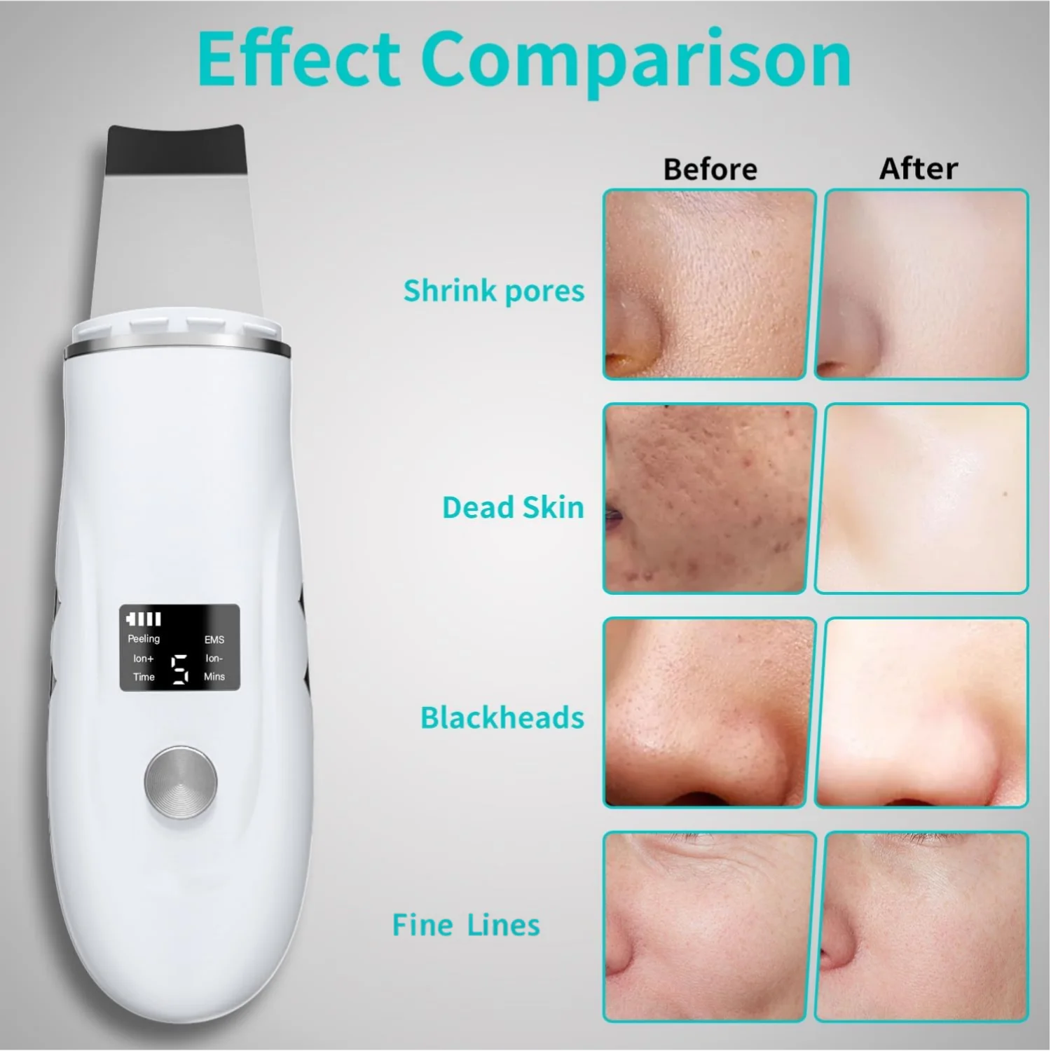 Ultrasonic Facial Skin Scrubber and Pore Cleaner - 3