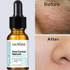 Pore Minimizing Face Serum for Skin Tightening and Repair