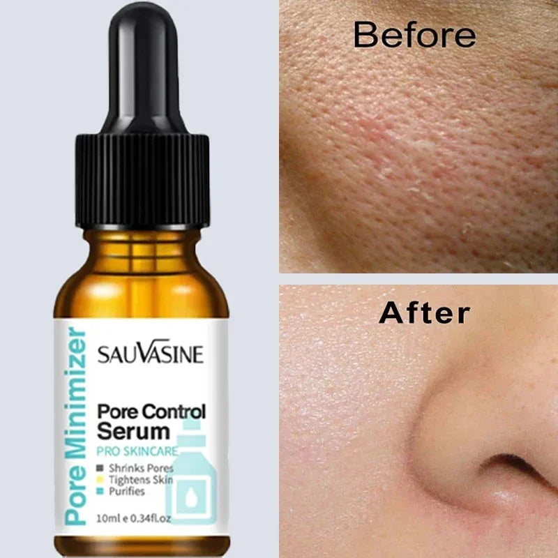 Pore Minimizing Face Serum for Skin Tightening and Repair