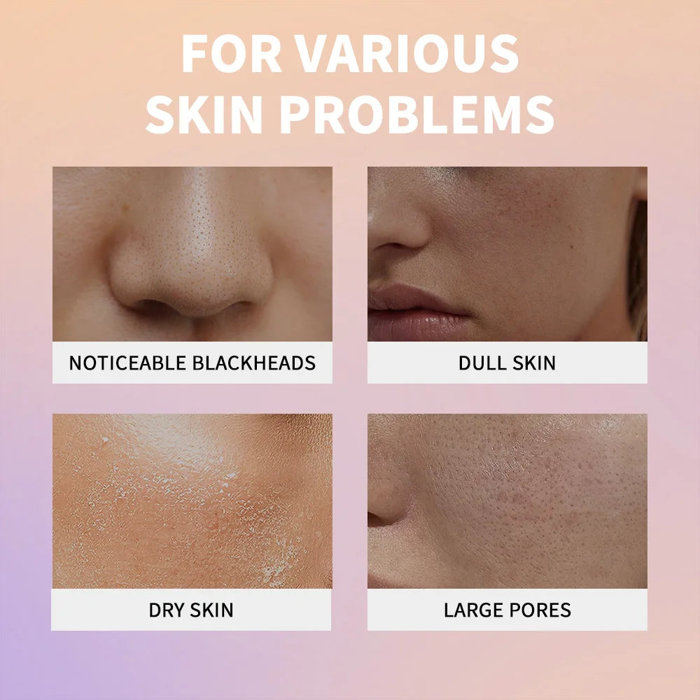 Exfoliating Rice Facial Essence for Brightening and Pore Refining - 6