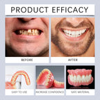 Silicone Dental Reline Kit for Temporary Tooth Repair and Smile Veneers