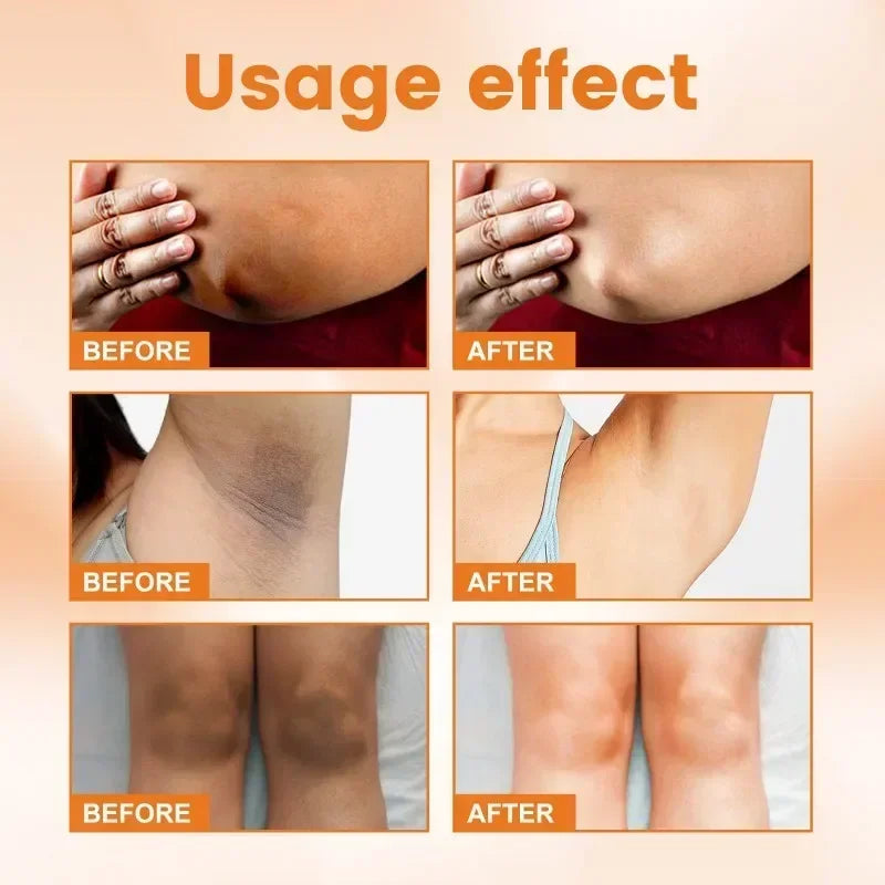 Vitamin C Skin Brightening Cream for Dark Spots and Underarms