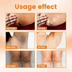 Vitamin C Skin Brightening Cream for Dark Spots and Underarms