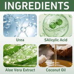 65% Urea Cream with Salicylic Acid for Rough Dry Hands and Feet 60g