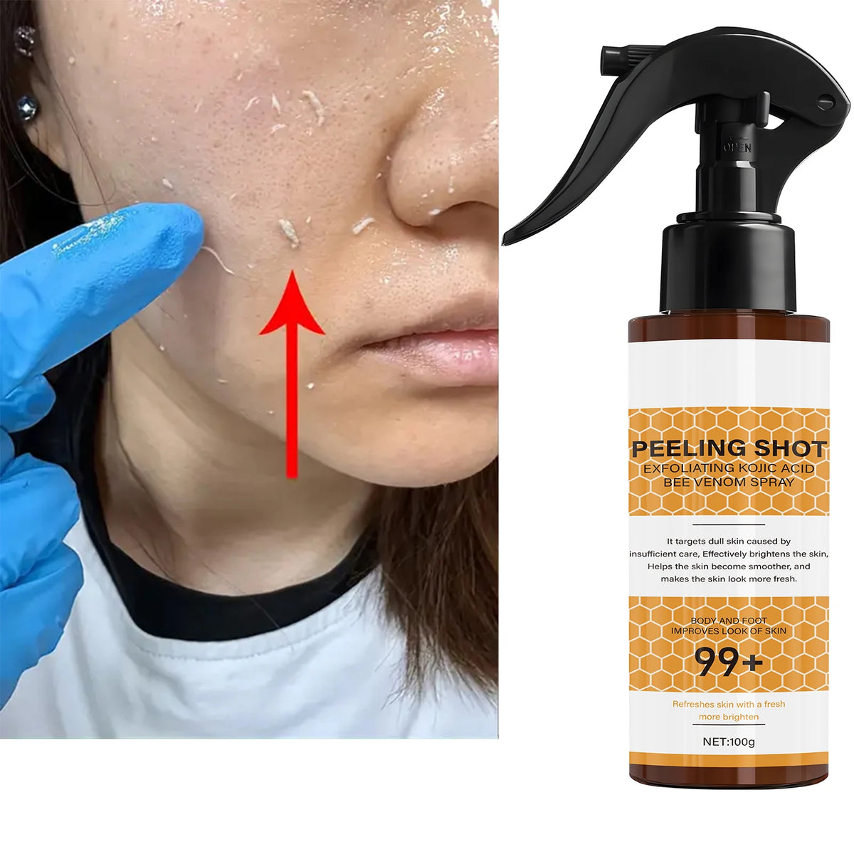 Retinol Bee Venom Peeling Spray Exfoliating Face and Body Treatment