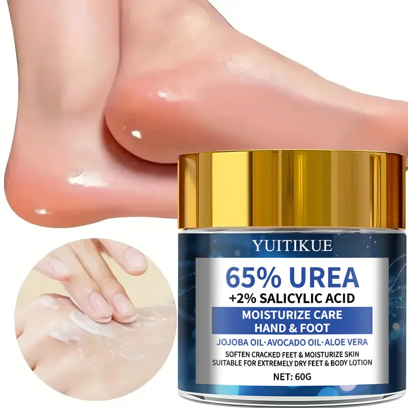 YUITIKUE 65% Urea Foot Cream Cracked Heel Repair Moisturizing Treatment - 1