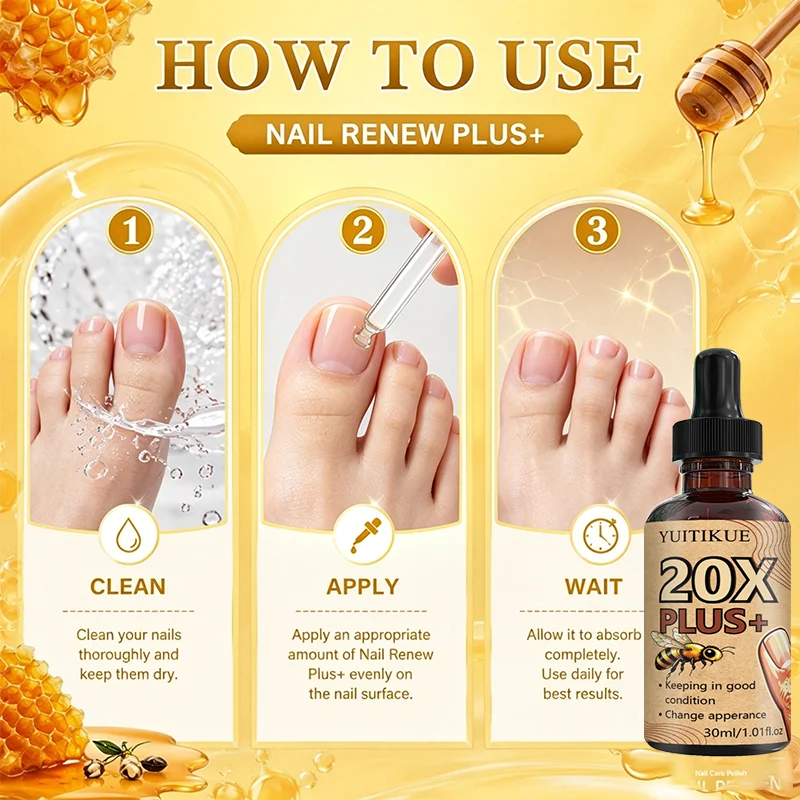 YUITIKUE 20X Nail Repair Oil Nourishing Cuticle and Nail Treatment 30ml