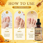 YUITIKUE 20X Nail Repair Oil Nourishing Cuticle and Nail Treatment 30ml