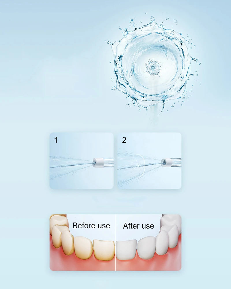 Mijia F300 Electric Oral Irrigator Portable Dental Water Flosser