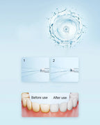 Mijia F300 Electric Oral Irrigator Portable Dental Water Flosser