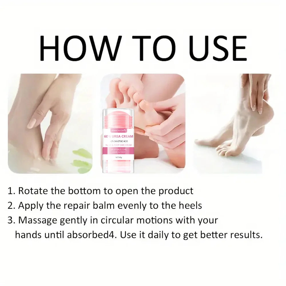 60% Urea Cream Moisturizing Hand and Foot Repair Treatment