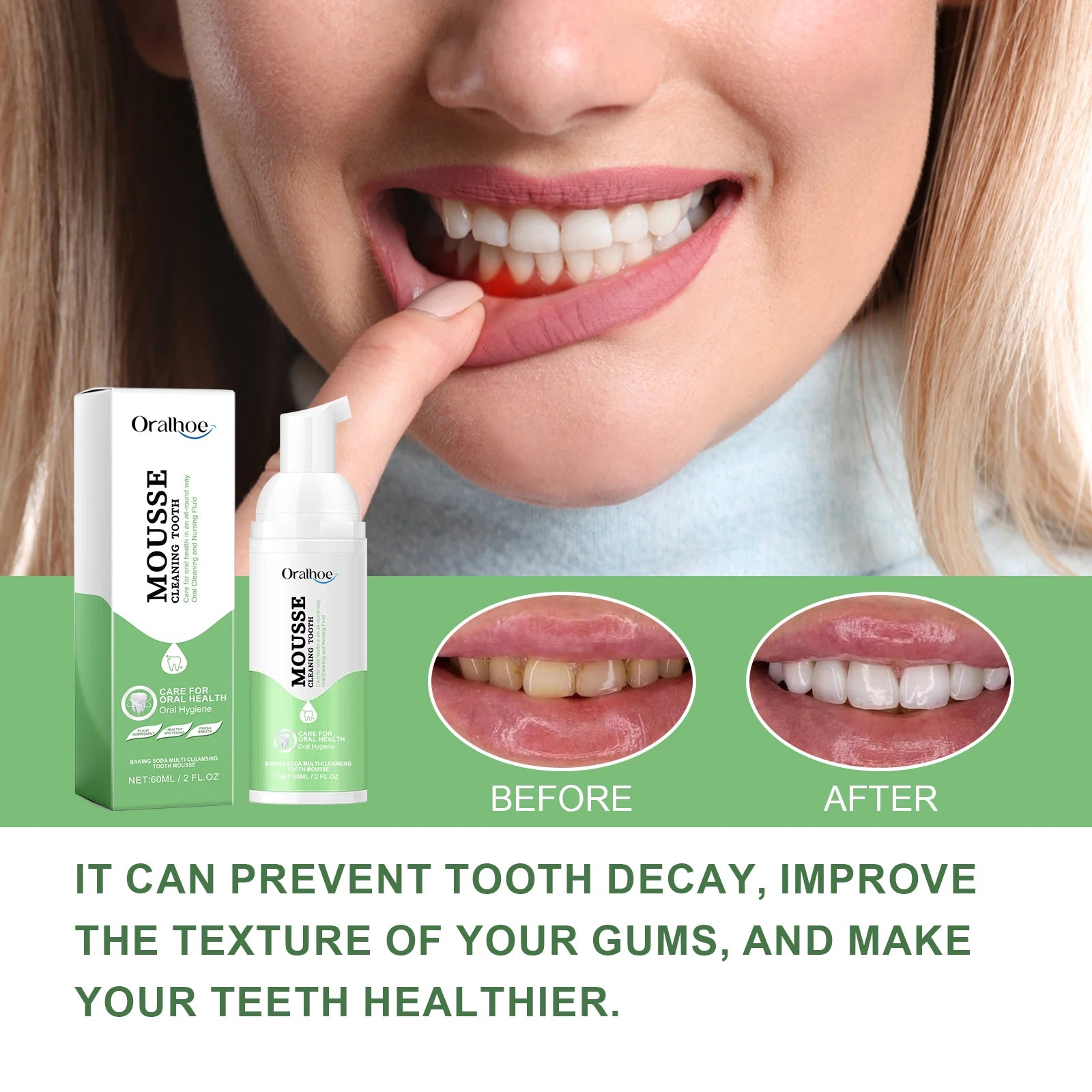 Whitening Foaming Toothpaste for Stain Removal and Fresh Breath - 8
