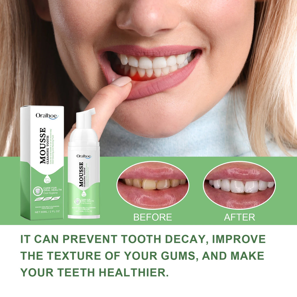 Whitening Foaming Toothpaste for Stain Removal and Fresh Breath