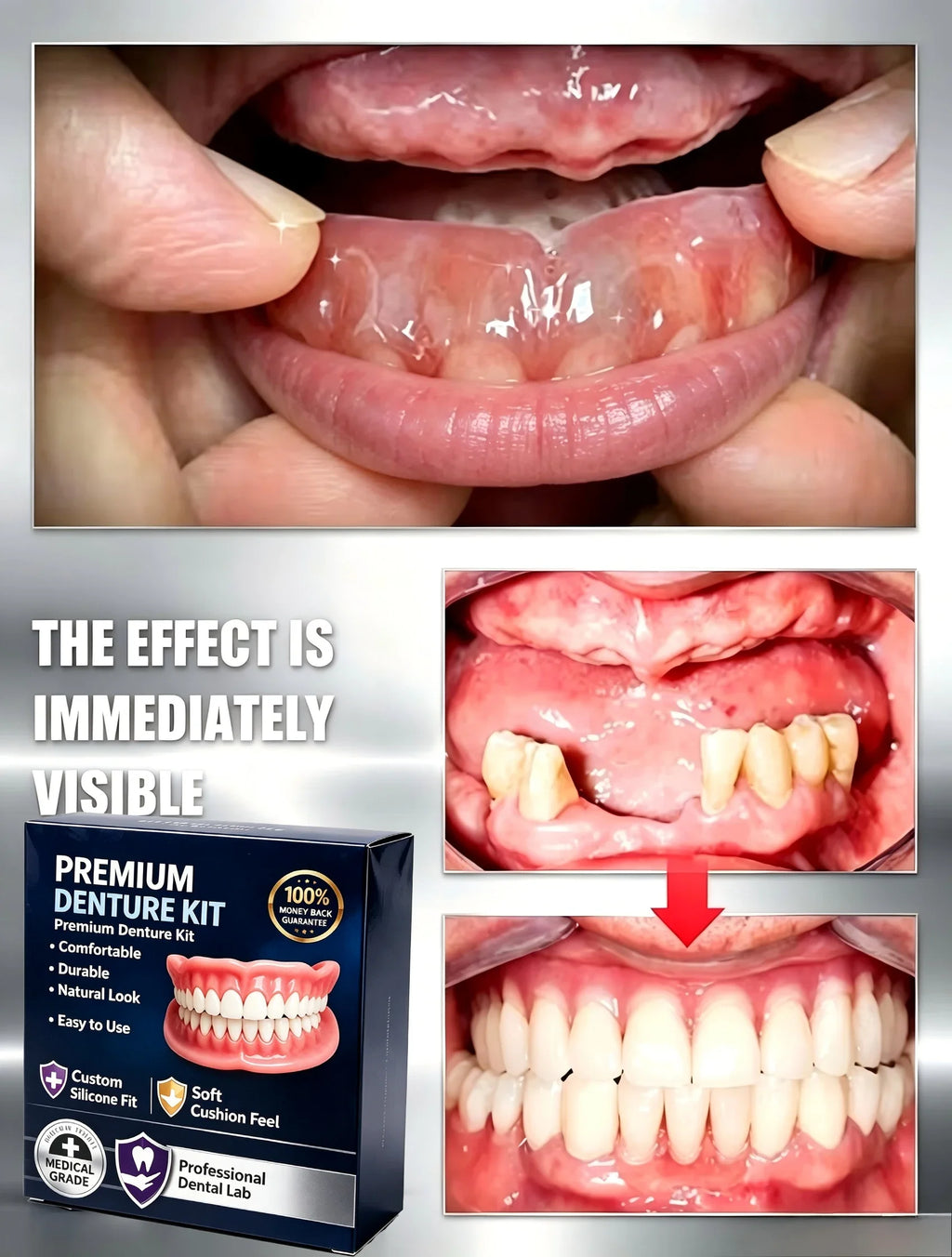 Temporary Silicone Cosmetic Denture Kit for Natural Smile