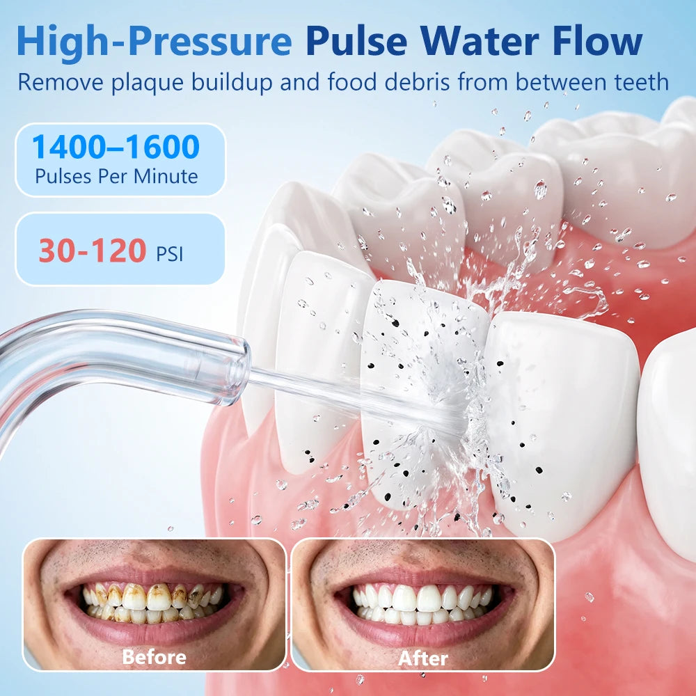 Portable Rechargeable Oral Irrigator Water Flosser for Teeth - 9