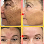 Anti-Aging Face Cream for Wrinkle Reduction and Skin Firming
