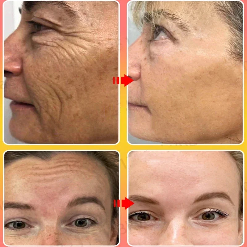Anti-Aging Face Cream for Wrinkle Reduction and Skin Firming