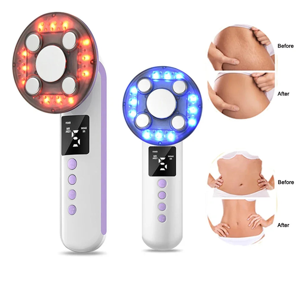 3-in-1 Cordless Body Slimming and Skin Tightening Massager - 1