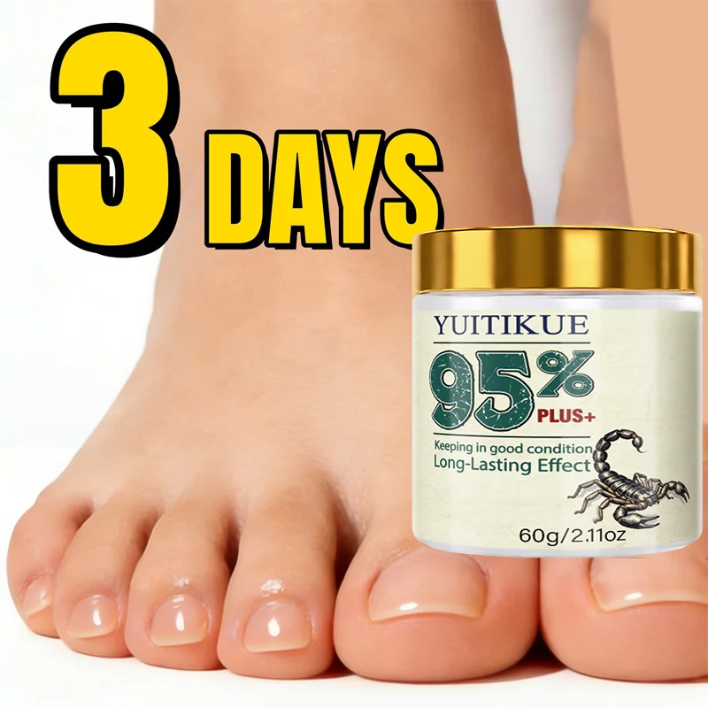 Yuitikue Nail Repair Cream Cuticle Softener and Foot Treatment Balm - 1