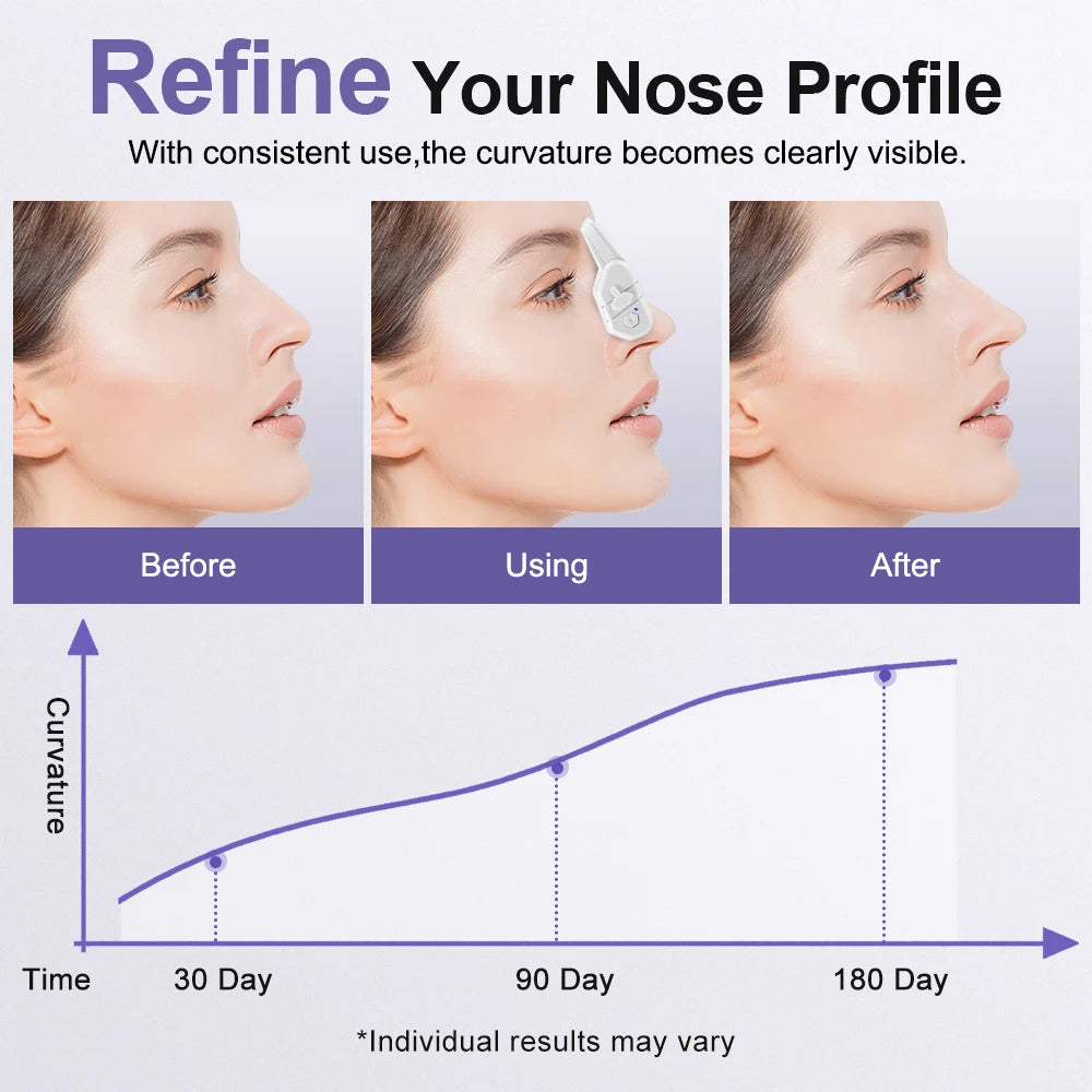 EMS Electric Nose Lifting and Shaping Massager - 9
