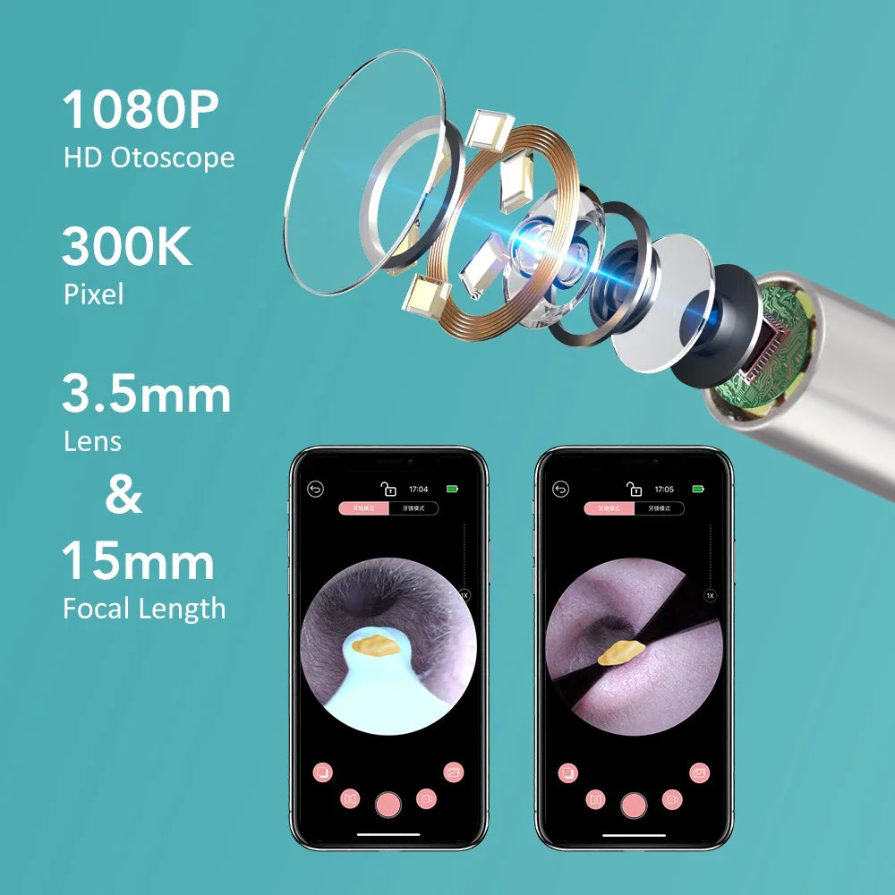 Smart Visual Ear Wax Removal Tool with HD Camera - 3