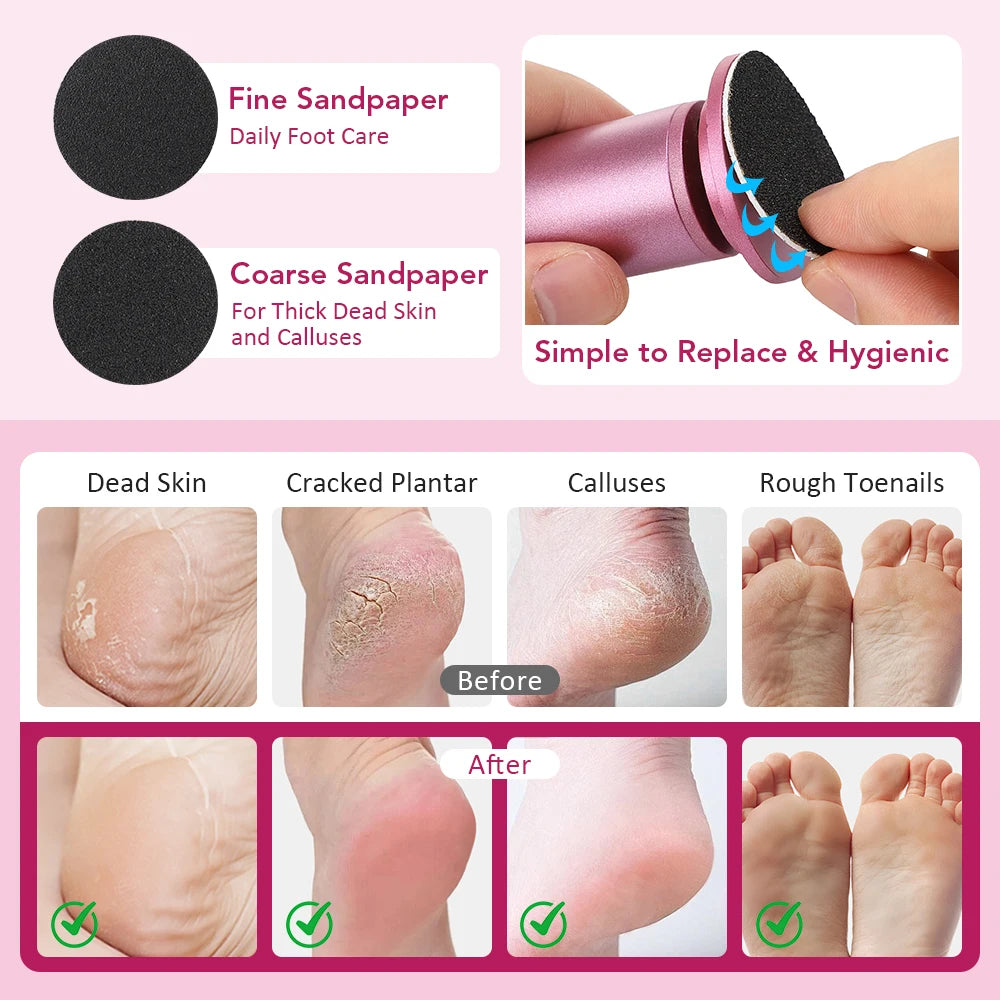 Electric Callus Remover for Smooth Heels - 4