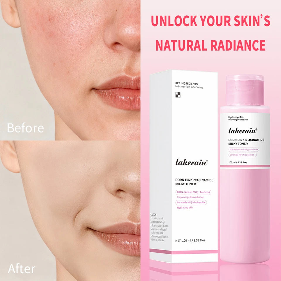 PDRN Niacinamide Milky Toner for Deep Hydration and Glowing Skin