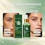 Vitamin C Hyaluronic Acid Facial Serum Brightening Moisturizing Essence
