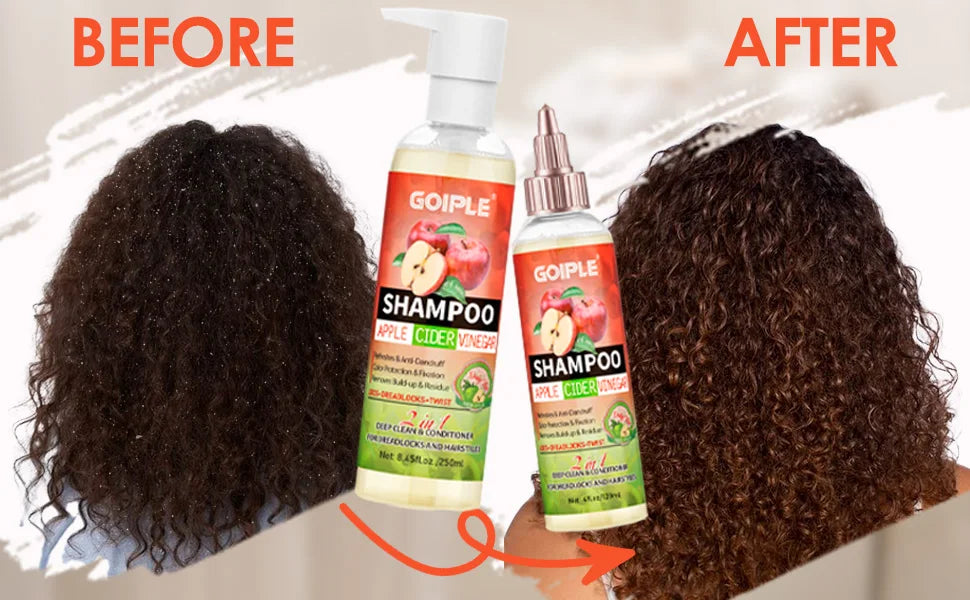 Goiple 2 in 1 Apple Cider Vinegar Shampoo and Conditioner for Locs - 12