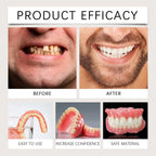 Temporary Silicone Denture Set for Smile Restoration