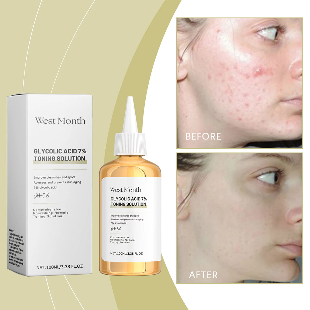 West Month Glycolic Acid 7 Percent Toning Solution Exfoliating Toner