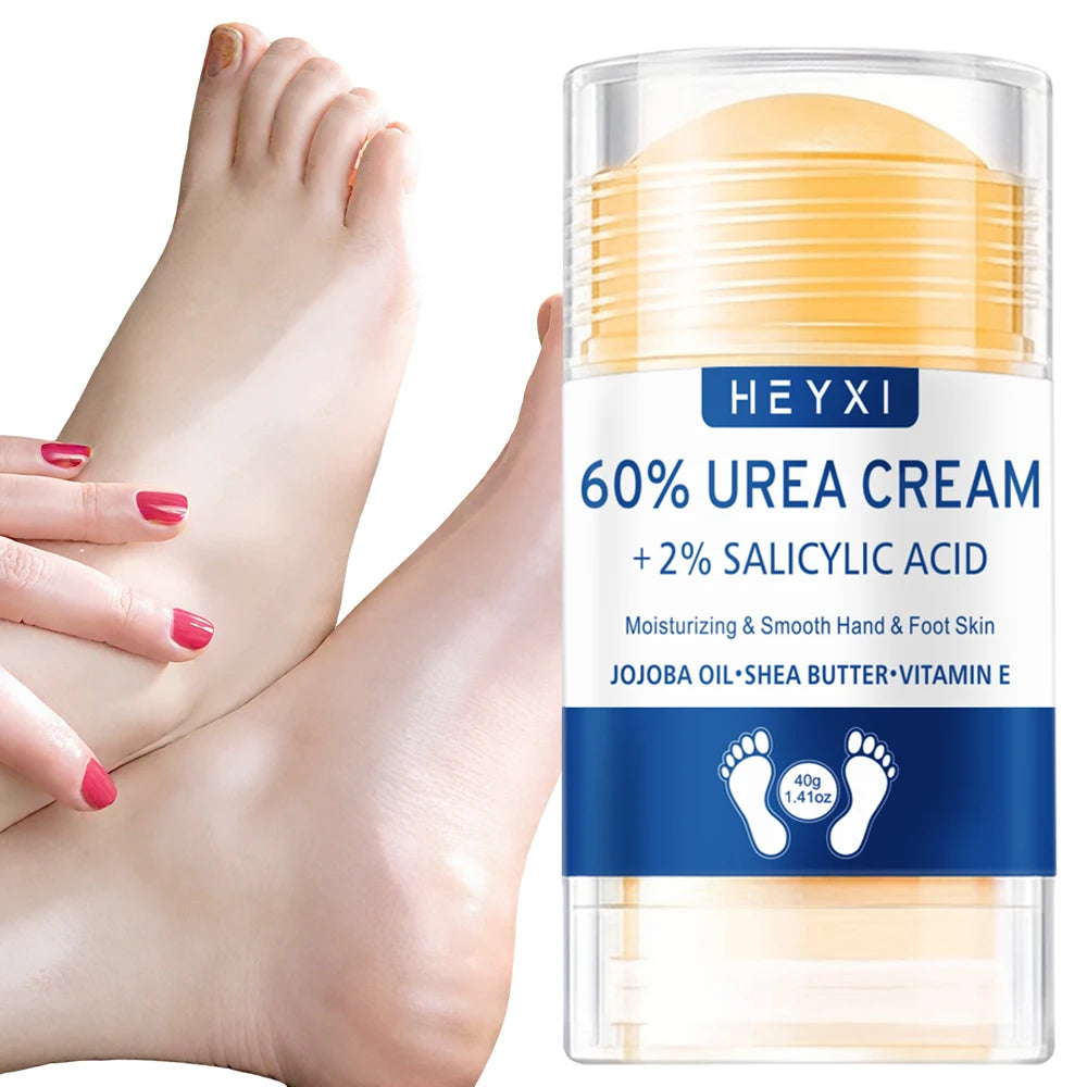 Heyxi 60 Percent Urea Cream Moisturizing Hand and Foot Repair Balm - 10