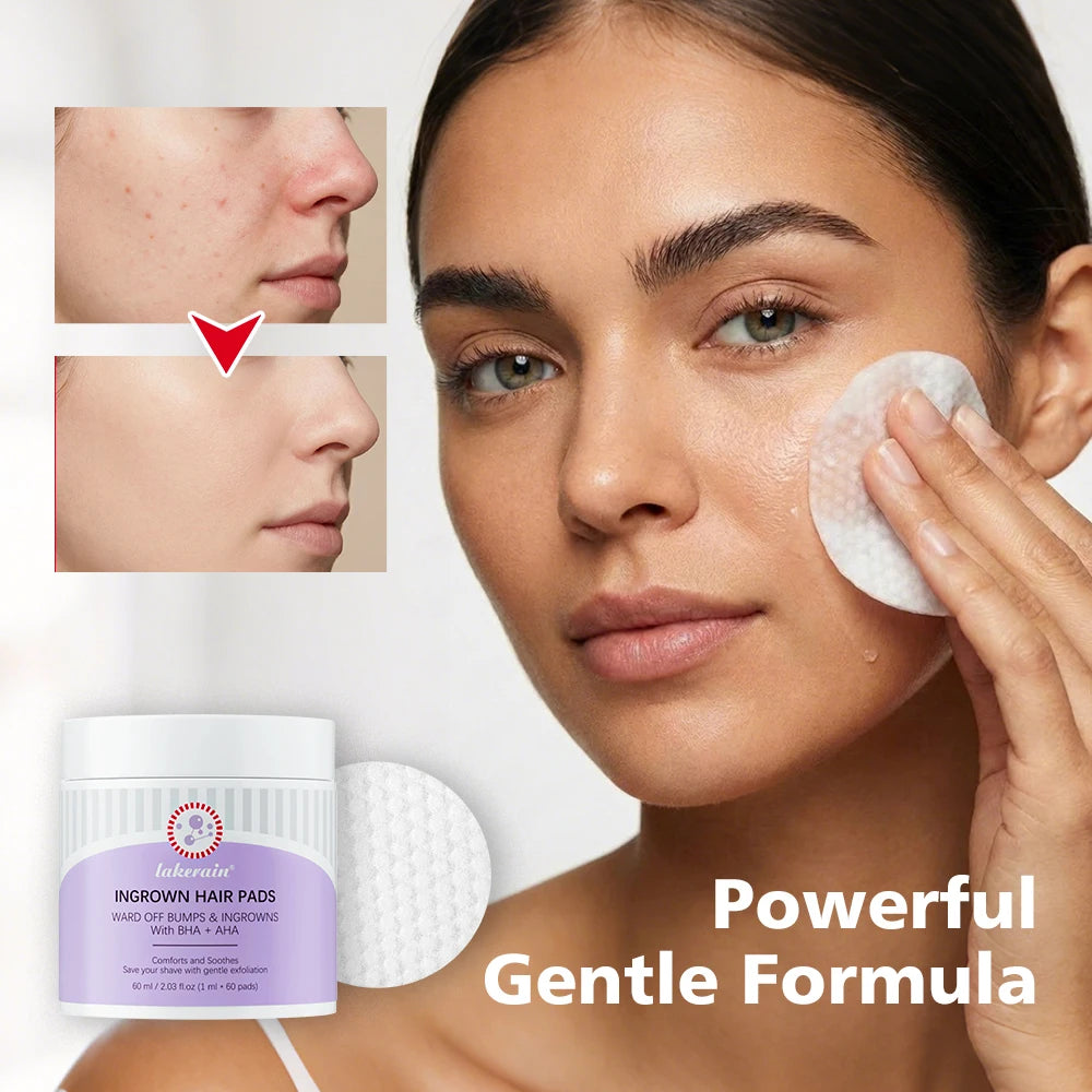 Ingrown Hair Treatment Pads for Razor Bumps and Shaving Irritation - 10