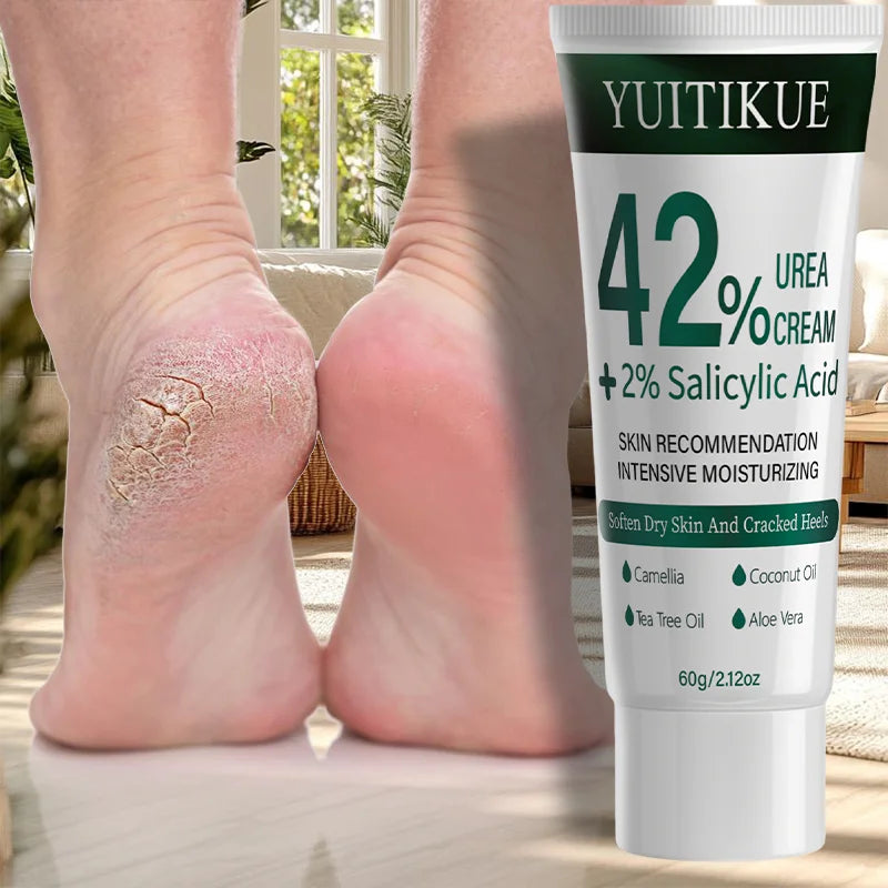 Yuitikue 42% Urea Cream with Salicylic Acid for Dry Skin and Cracked Heels