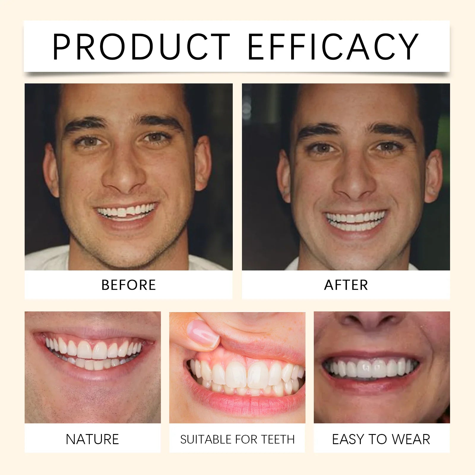 Temporary Silicone Denture Set for Smile Restoration - 4