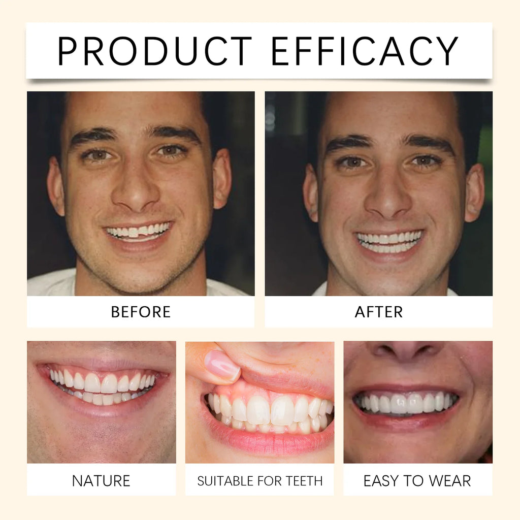 Temporary Silicone Denture Set for Smile Restoration