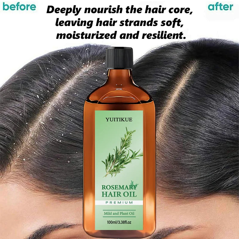 Rosemary Hair Oil 100ml Plant Based Nourishing Scalp Conditioner - 6