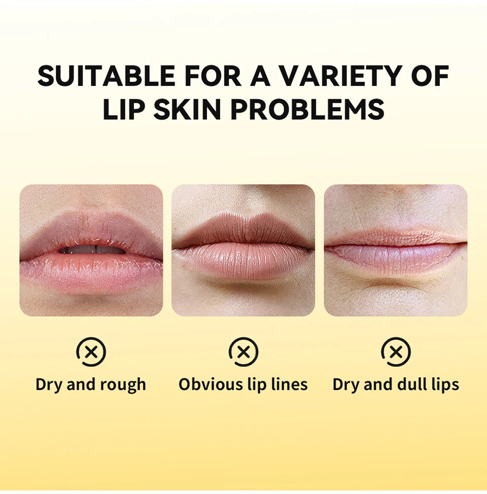 Propolis Hydrating Lip Gel for Dry and Chapped Lips - 8