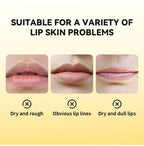 Propolis Hydrating Lip Gel for Dry and Chapped Lips