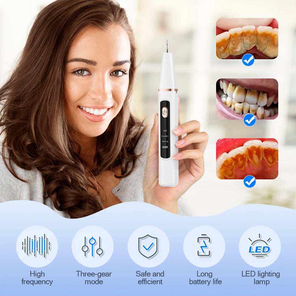 Ultrasonic Electric Teeth Tartar and Plaque Remover