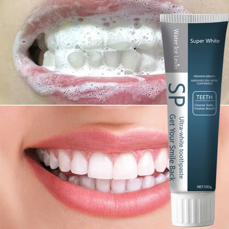 SP Probiotic Teeth Whitening Toothpaste Stain Removal and Breath Freshener