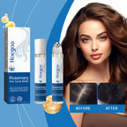 Rosemary Scalp Stimulating Hair Growth Serum Roller
