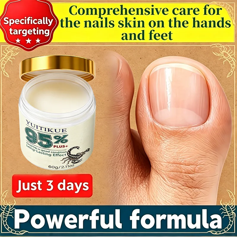 Yuitikue Nail Repair Cream Cuticle Softener and Foot Treatment Balm