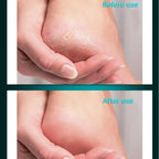 Professional Stainless Steel Foot File for Callus and Dead Skin Removal