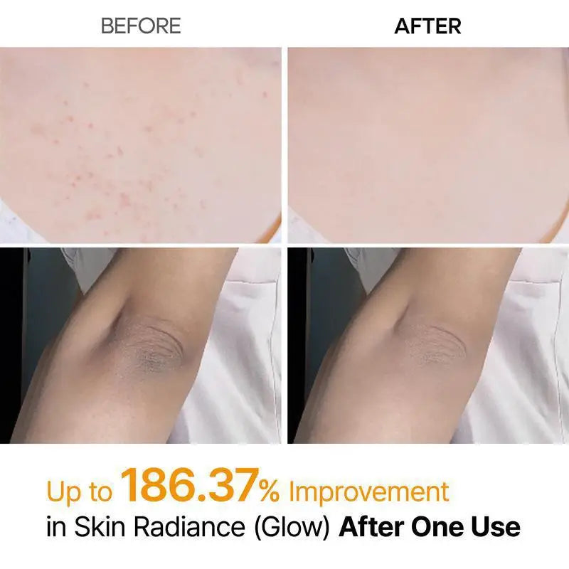 FLEXQW Kojic Acid Turmeric Exfoliating Body Scrub Spray for Smooth Skin - 6