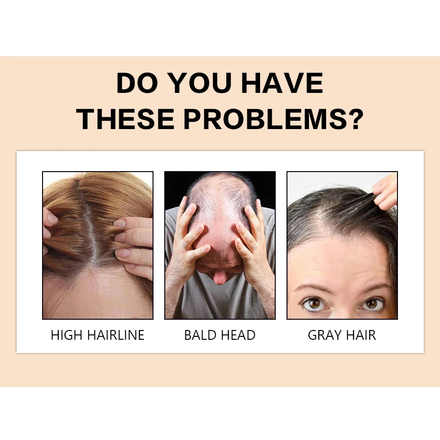 Hair Building Fibers Powder 27.5g for Thickening Thinning Hair
